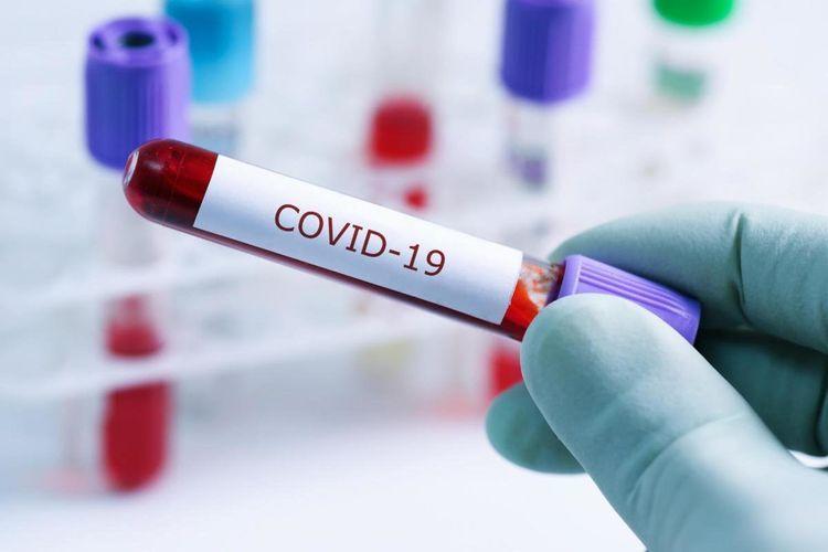 TƏBİB назвал количество проведенных за сегодня тестов на коронавирус