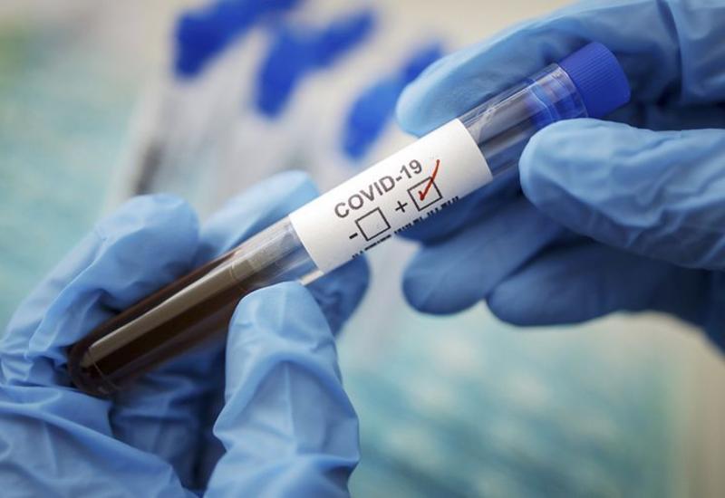 Число инфицированных коронавирусом в Грузии достигло 828