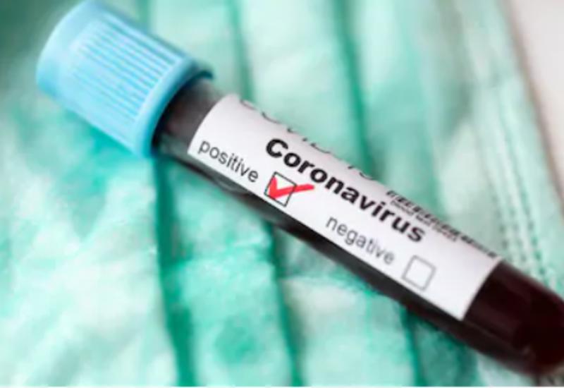 В Азербайджане выявлено 534 новых случая заражения коронавирусом, 307 вылечившихся, 5 скончались