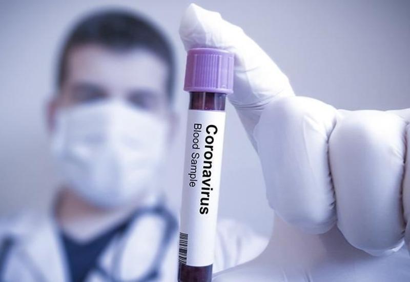 В Азербайджане выявлено 534 новых случая заражения коронавирусом, 471 вылечившийся, 6 скончались