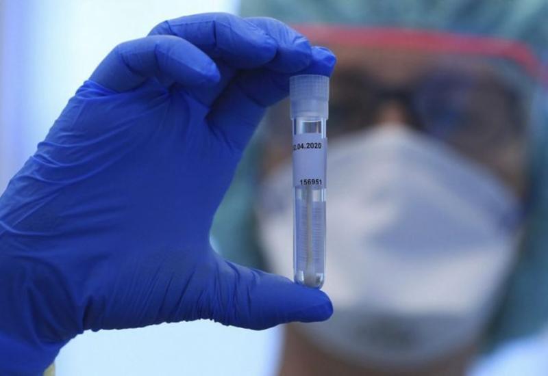 В США за последние сутки от коронавируса умерли 290 человек