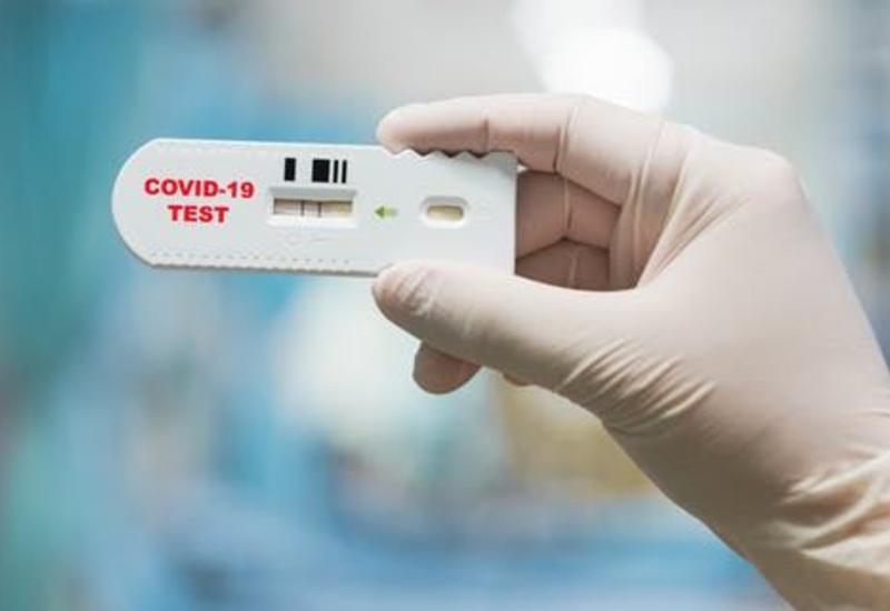Названо количество произведенных в Азербайджане ПЦР-тестов на коронавирус