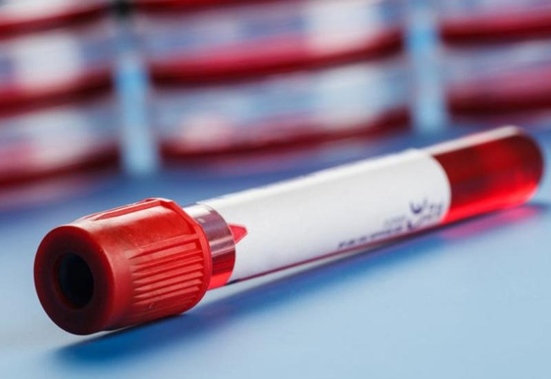 Ученые назвали группу крови, которая имеет повышенный риск развития рака