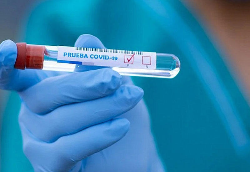 В Грузии за сутки выявлено 544 случая заражения коронавирусом