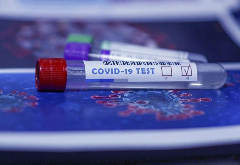 В Армении за сутки еще 263 человека заразились COVID-19