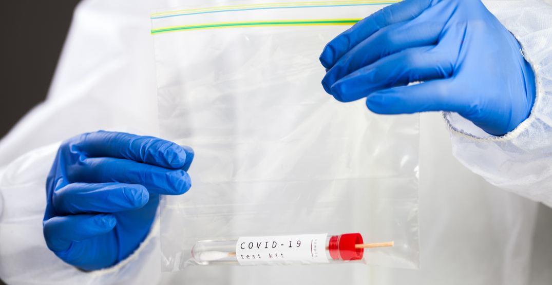 Во Франции начнут продаваться тесты на коронавирус