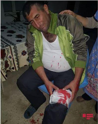 Фотографии пострадавших от атаки ВС Армении мирных азербайджанцев