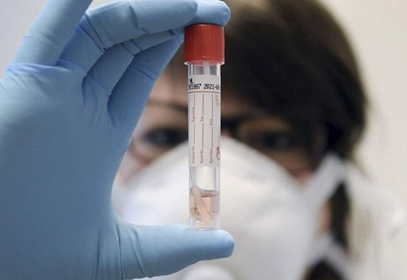 В Иране объявили о начале испытаний вакцины от коронавируса собственной разработки