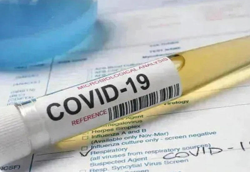 В Грузии за сутки выявлено 829 случаев заражения коронавирусом