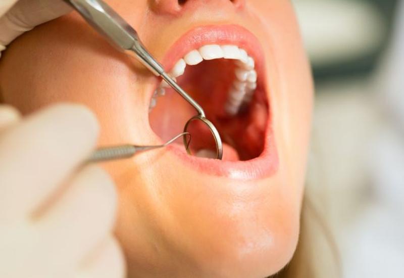 Больные зубы могут стать причиной гайморита
