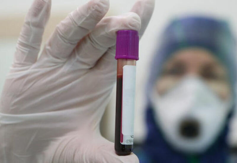Ученые выяснили связь между группой крови и заболеваниями