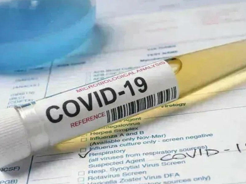 В Азербайджане за сутки выявлено 996 случаев заражения коронавирусом