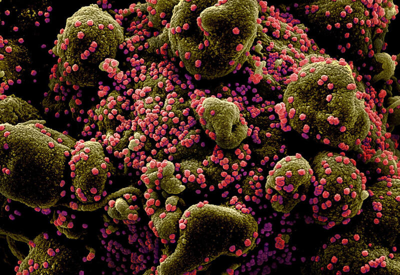 Обнаружен новый потенциально опасный для людей вид коронавируса