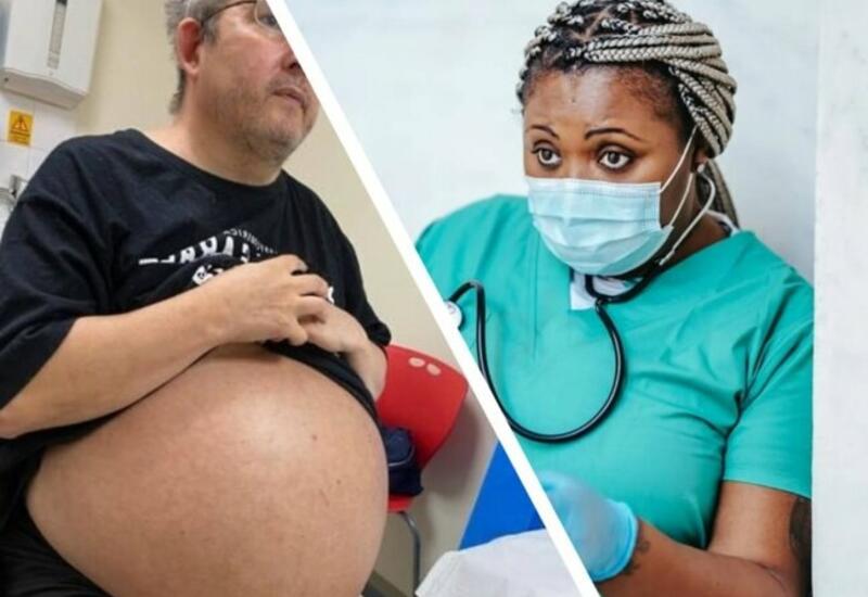 Bu kişi hamilə deyil, sadəcə böyrəkləri 35 kiloqramdır