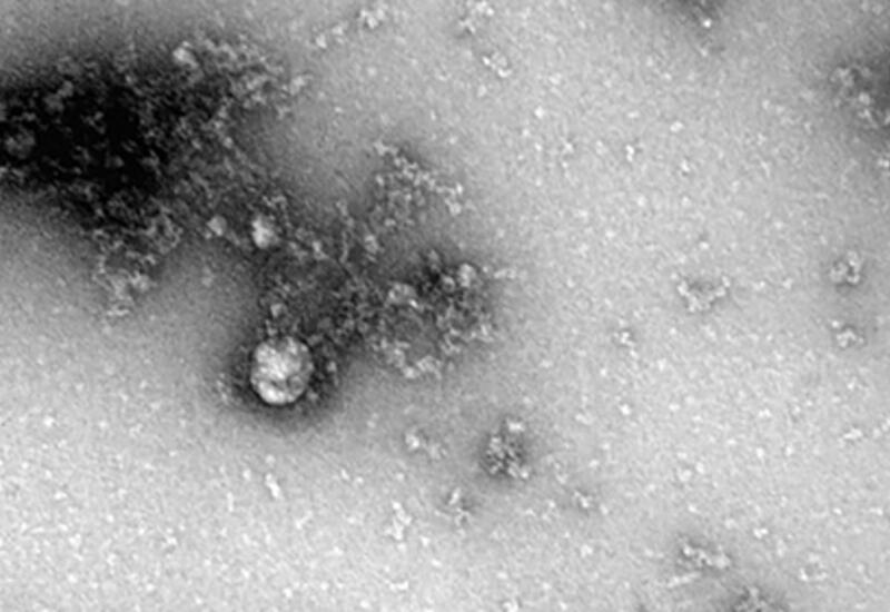 Впервые опубликованы фотографии «дельта»-штамма коронавируса
