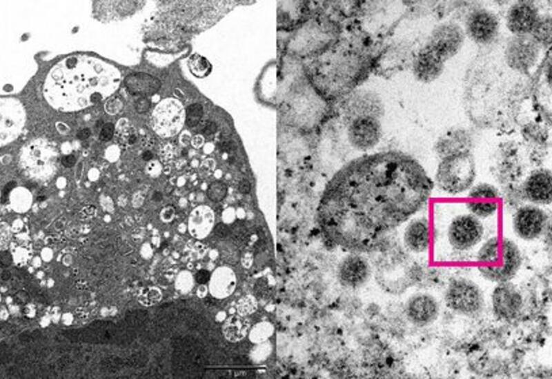 Ученым удалось сфотографировать омикрон-штамм коронавируса