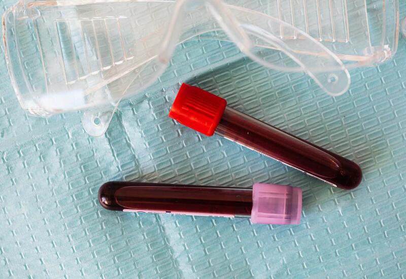 Физики придумали, как заряжать импланты от глюкозы в крови