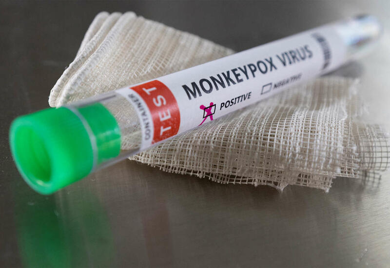 Иммунолог спрогнозировал сроки выявления оспы обезьян в России