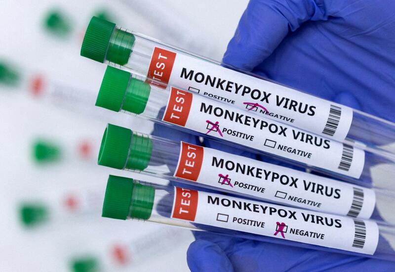 Во Вьетнаме выявили первый случай заражения вирусом оспы обезьян