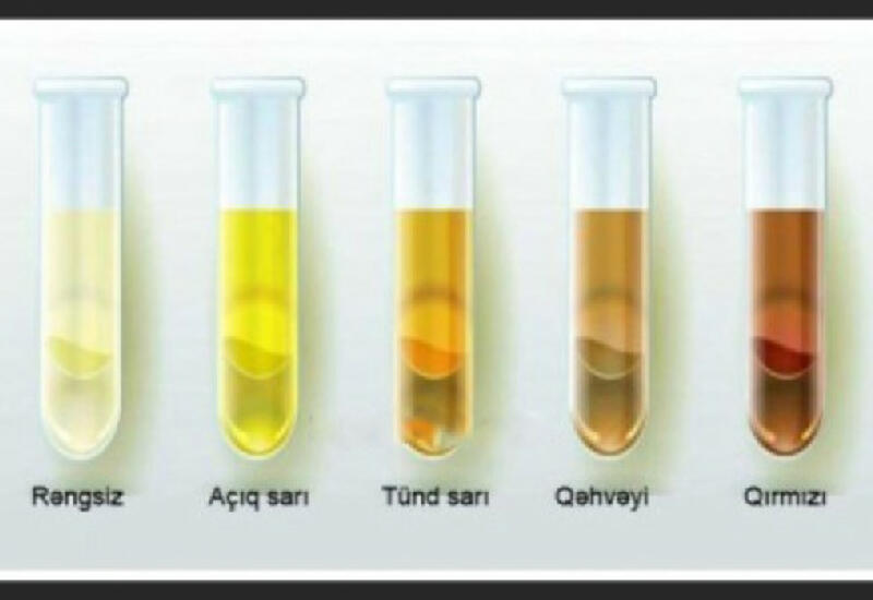 Цвет мочи норма
