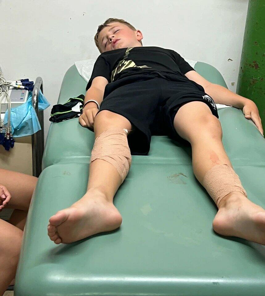 Акулы разодрали ноги восьмилетнему мальчику