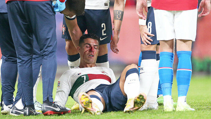 Роналду разбили нос в матче сборной Португалии с чехами