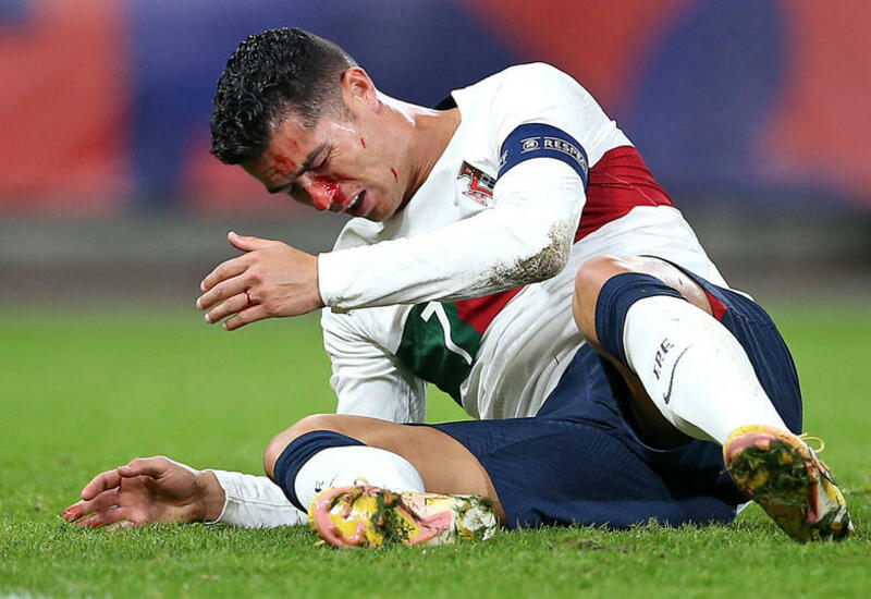 Роналду разбили нос в матче сборной Португалии с чехами