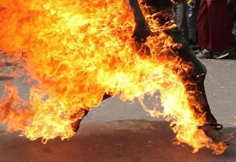 В Газахе гражданин Турции получил ожоги