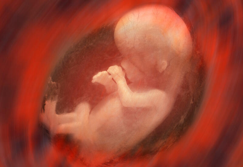 Индийские врачи извлекли 8 эмбрионов из брюшной полости девочки-младенца