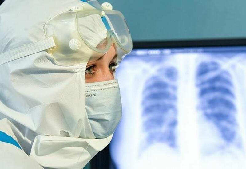Терапевт Гюнай Исмайылова: Предупредить пневмонию гораздо проще, чем вылечить