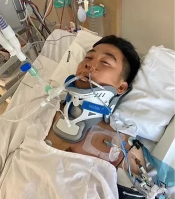 Турист из Японии нырнул в бассейн и остался парализован