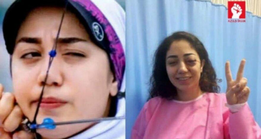 Террорист лишился глаза. Азербайджанские женщины. Мона иранская спортсменка. Девушка лишилась глаза выстрел. Из-за фото.