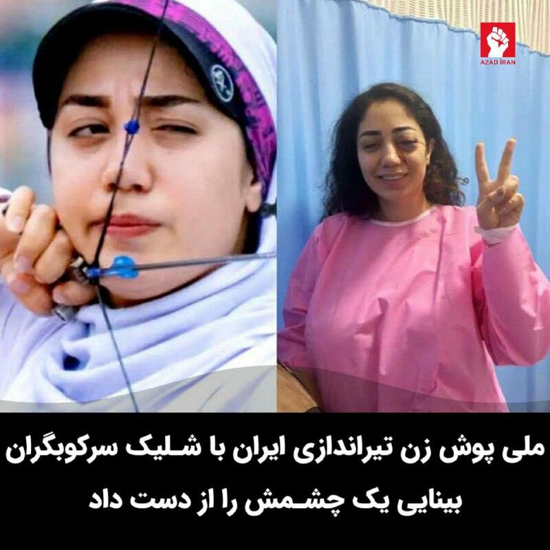 Иранская спортсменка лишилась глаза из-за выстрела силовиков