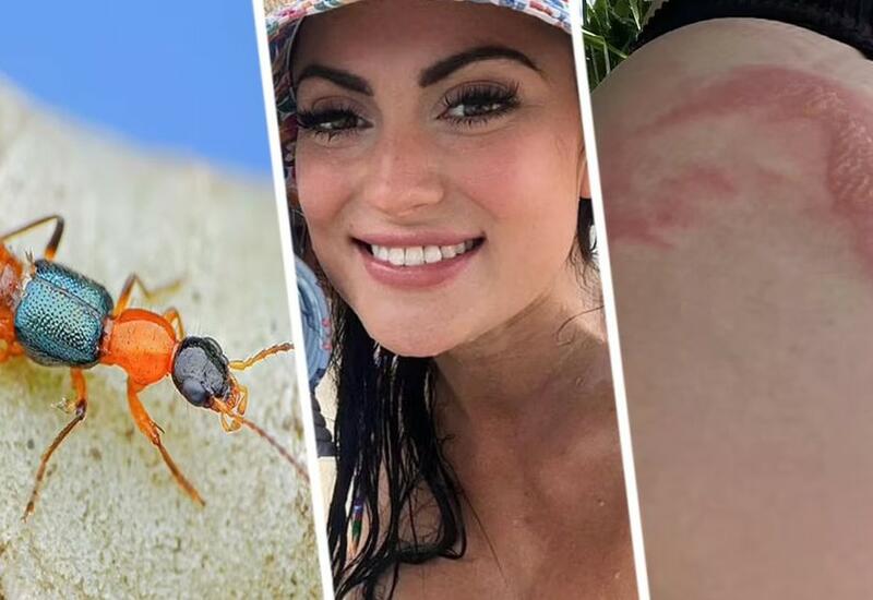 Туристка попала под капельницу после того, как по ней прополз опасный жук на популярном курорте