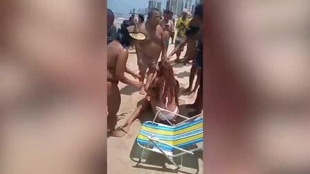 Акула оторвала руку девушке в Бразилии