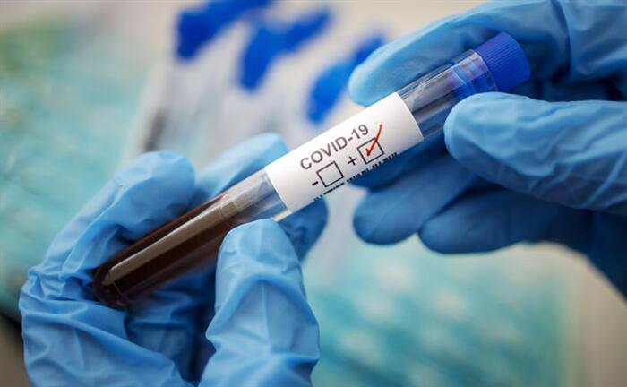 Выявлены новые случаи заболевания коронавирусом в Азербайджане
