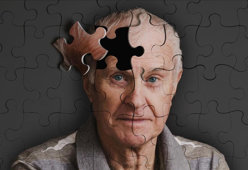Обнаружен способ подавить болезнь Альцгеймера