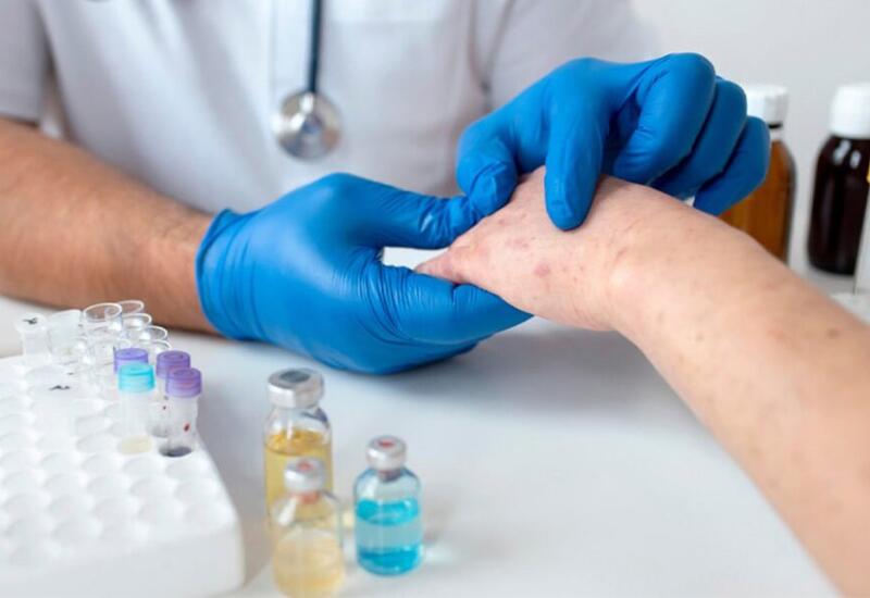 Минздрав раскрыл количество вакцинированных против кори