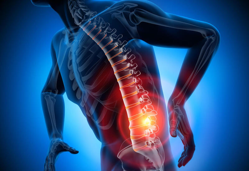 Нейрохирург назвал основные симптомы грыжи в спине