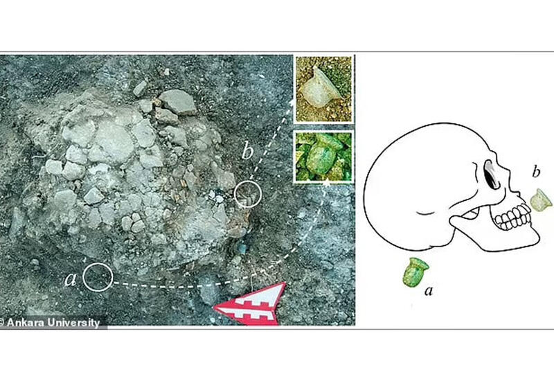 Археологи нашли в Турции древнейшие свидетельства пирсинга