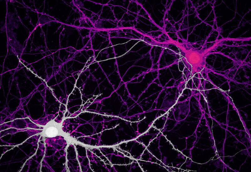 Изменения клеток человеческого мозга озадачили ученых