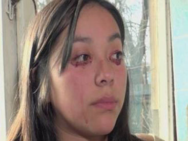 20-летняя чилийка плачет кровавыми слезами - ВИДЕО