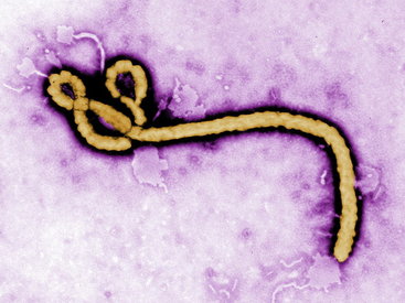 Вакцину от Эболы начали тестировать на людях
