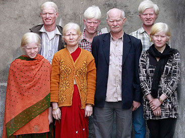 В Индии объявился самый большой в мире клан альбиносов – ФОТО