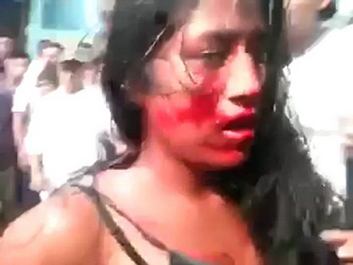 Мужчины избили и сожгли девушку на глазах у полицейских - ФОТО - ВИДЕО