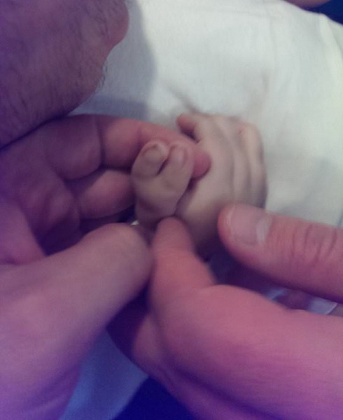 В Азербайджане родился ребенок с 11 пальцами – ФОТО