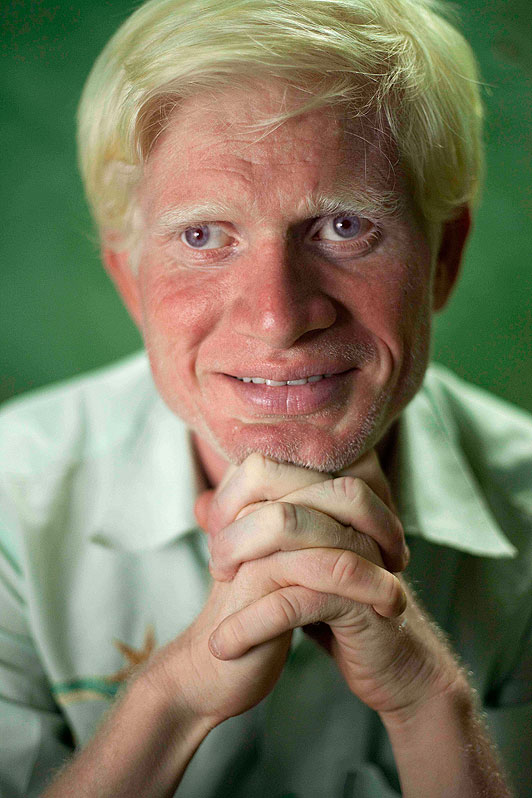 В Индии объявился самый большой в мире клан альбиносов – ФОТО