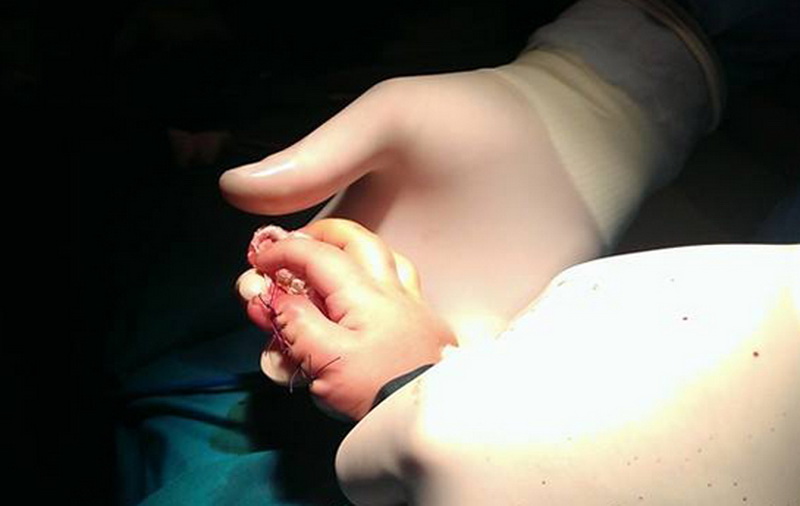 В Азербайджане родился ребенок с 11 пальцами – ФОТО