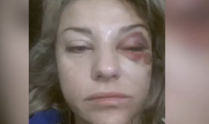 Известный российский актер избил жену до состояния комы - ФОТО