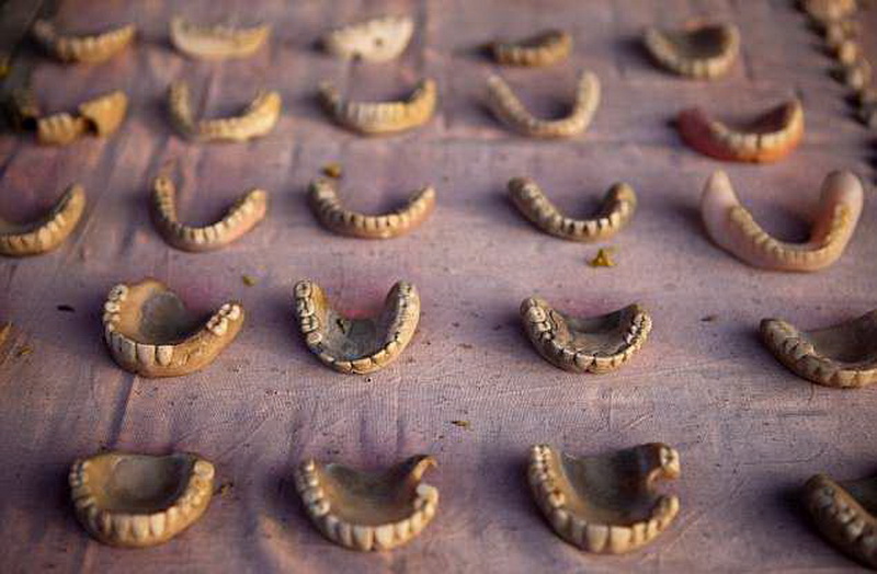 В Индии зубы лечат прямо на улице - ФОТОСЕССИЯ